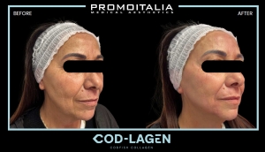 cod-lagen promoitalia